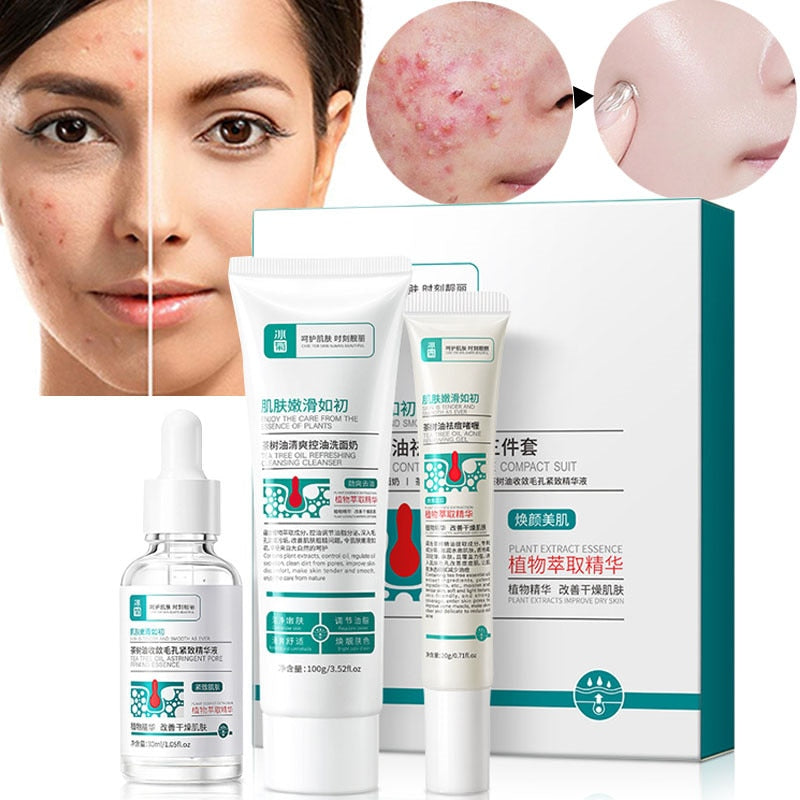 ClearGlow™ Herbal Acne Vanishing Cream