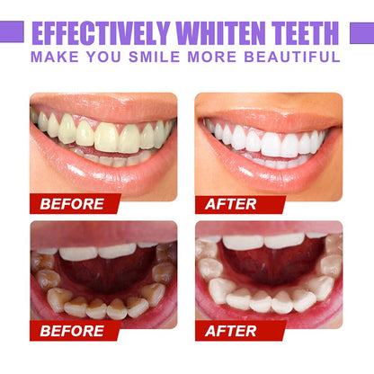 EverySmile™ Color Correcting Teeth Brightener