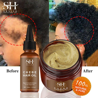 SEVICH™ African Crazy Hair Growth Set