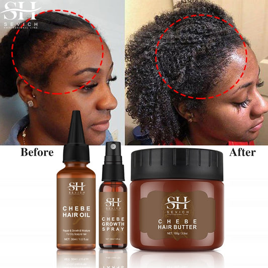 SEVICH™ African Crazy Hair Growth Set